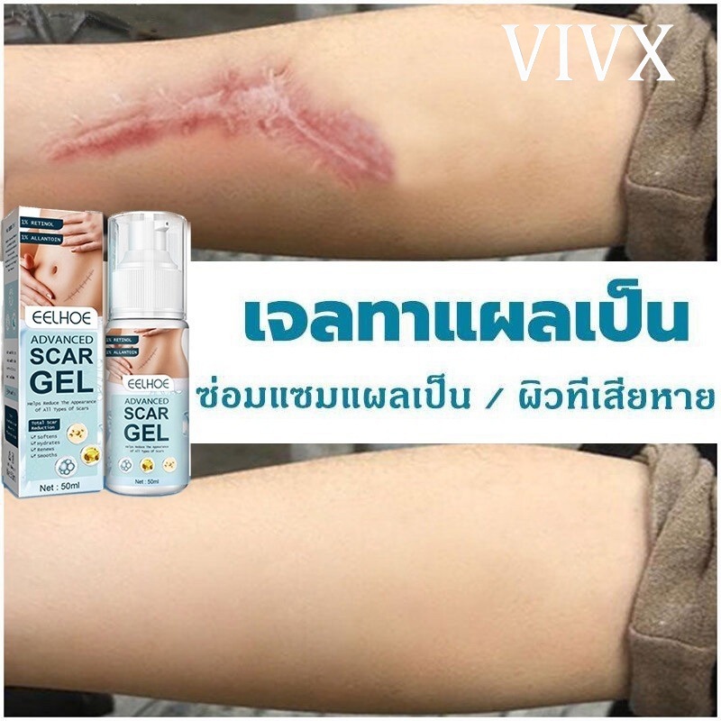 EELHOE ซ่อมแซมผิวที่เสี 50g ครีมทาแผลรอยดำ ลบรอยแผลเปน ครีมลดรอยแผลเป็น แผลผ่าตัด เหมาะสำหรับผิวรอยแตกลาย น้ำร้อนลวก