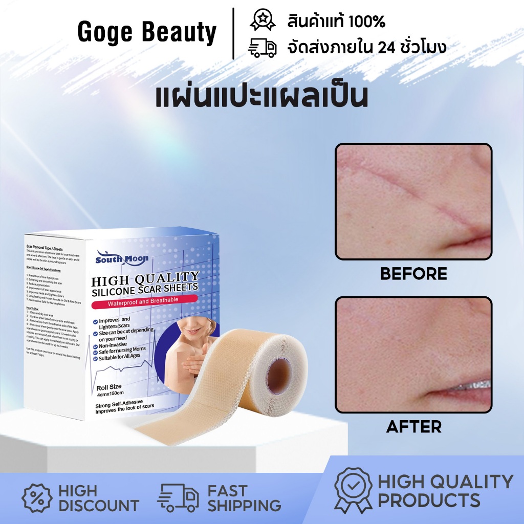 South Moon แผ่นแปะแผลเป็น เทปเจลแผลเป็นไหม้ รักษารอยแผลเป็น กำจัดรอยแผลเป็นจากแผลเป็น