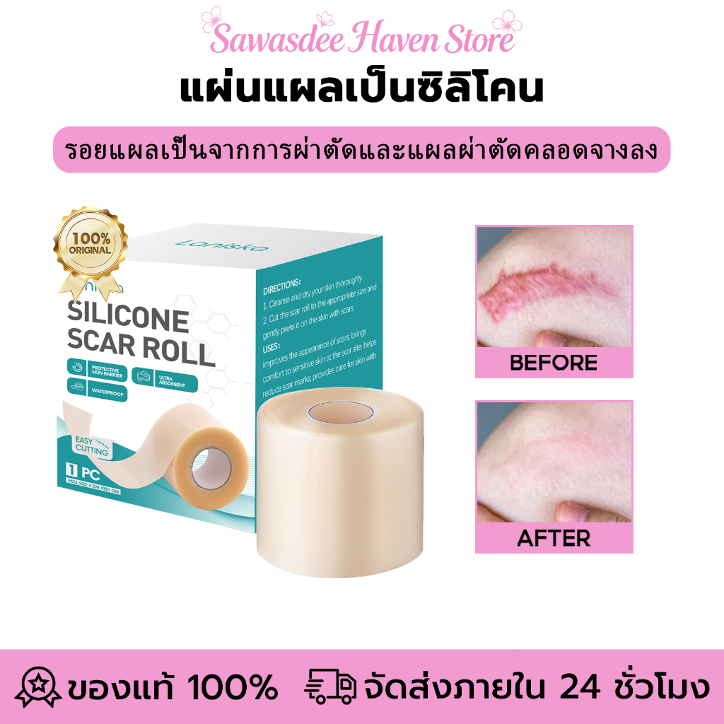 Laniska แผ่นแผลเป็นซิลิโคน Silicone Scar Roll แผ่นแปะแผลเป็น ลดรอยแผลเป็นนูน แผลคีลอยด์ คีลอยด์สิว