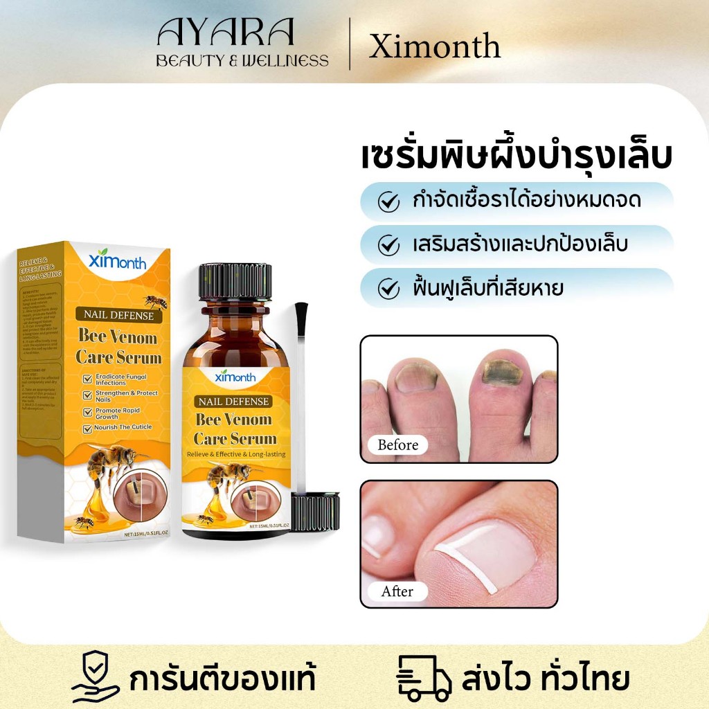 Ximonth น้ำยารักษาเชื้อราที่เล็บ ฆ่าเชื้อราที่เล็บ บำรุงเล็บ เชื้อราเล็บเชื้อราที่เล็บฆ่าเชื้อราเล็บ