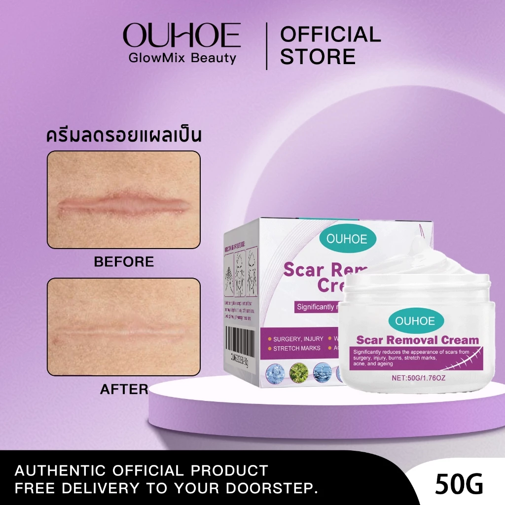 OUHOE ครีมทาแผลเป็น ลดรอยแผลเป็น ผิวเรียบเนียน รักษาแผลนูน ลดรอยแดง กระชับผิว