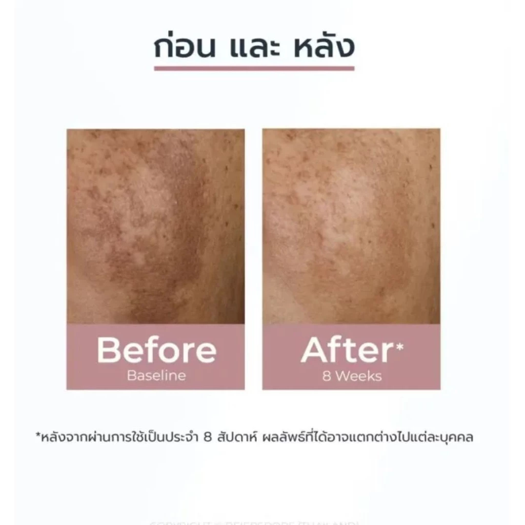 ครีมลดฝ้า EELHOE ลดกระ รอยดำ รอยแดง ผิวเรียบเนียน กระจ่างใส thumbnail 7