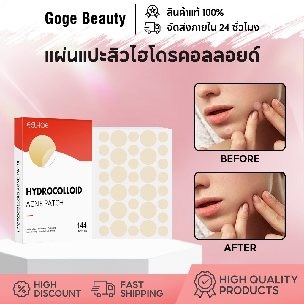 EELHOE แผ่นแปะสิว แผ่นแปะสิวไฮโดรคอลลอยด์ กันน้ำ ดูดซับสิวได้ดี สำหรับทุกสภาพผิว 144ชิ้น