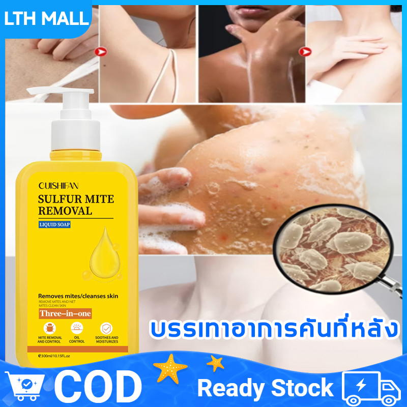 ครีมอาบน้ำเจลอาบน้ำสูตรเข้มข้น ลดสิว กำจัดไร คุมความชุ่มชื้นผิว แก้คัน กลิ่นหอมติดทน 300ml