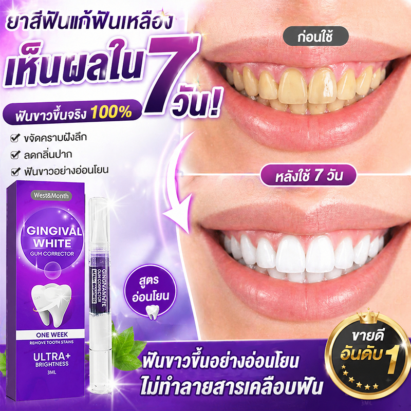 【มีสต๊อกในไทย】ขจัดกลิ่นปากทำความสะอาดฟัน ปากกาฟอกสีฟัน ละลายหินปูนฟันลึก หินปูนฟันลดลง คราบหินปูนฟันฟันไวท์เทนนิ่ง