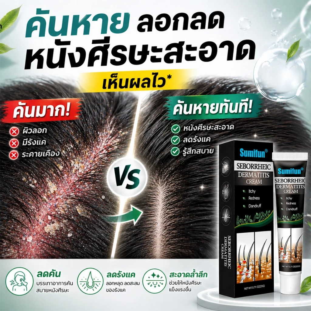 ครีมลดอาการคัน 20g ทาแก้คัน ผิวหนังทากากเกลื้อน สารสกัดจากพืชใช้ได้ กลากเกลื้อน สะเก็ดเงิน สิวที่หลัง เชื้อรา
