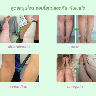 ครีมทาสังคัง สะเก็ดเงินครีม ครีมบำรุงผิว 20g รอยแดง โรคผิวหนัง เกลื้อน กลาก คัน สมุนไพร แก้คันเรื้อรัง คันในร่มผ้า
