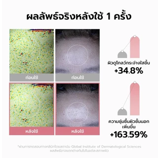 Medicube PDRN Pink Vita Coating Mask 1 Pc เมดิคิวบ์ พีดีอาร์เอ็น พิงค์ วิต้า โค้ตติ้ง มาส์ก