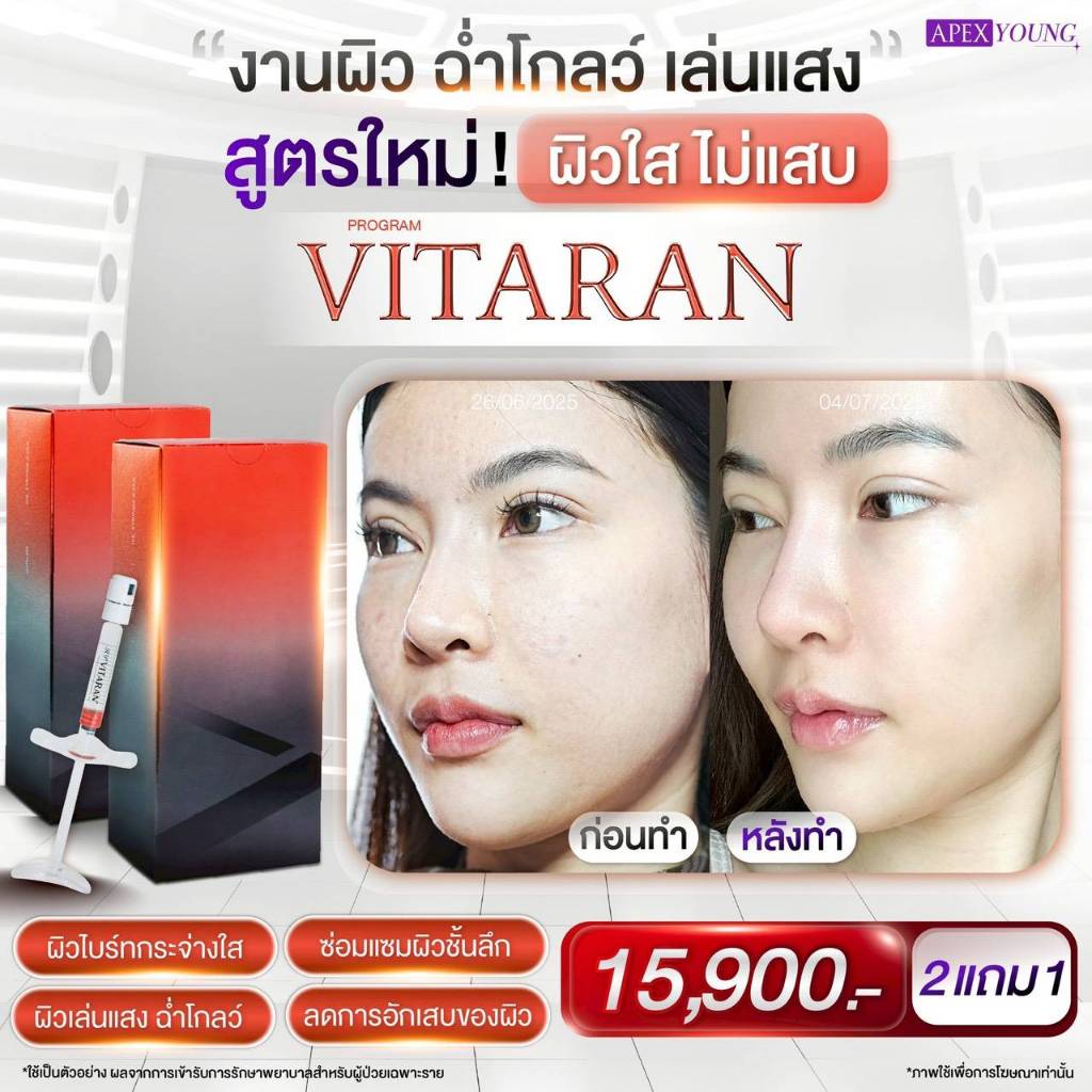 [E-Voucher] APEX โปรแกรม VITARAN อัพผิวใส เล่นแสง ฉ่ำโกลว์ ลดการอักเสบเร่งด่วน หน้าใสไวไม่แสบผิว