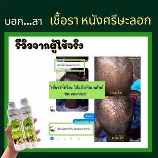 แชมพูอัลตร้ามายด์ แก้คัน รังแค เชื้อราหนังศีรษะ สเก็ตเงิน บำรุงผมให้ดกดำ