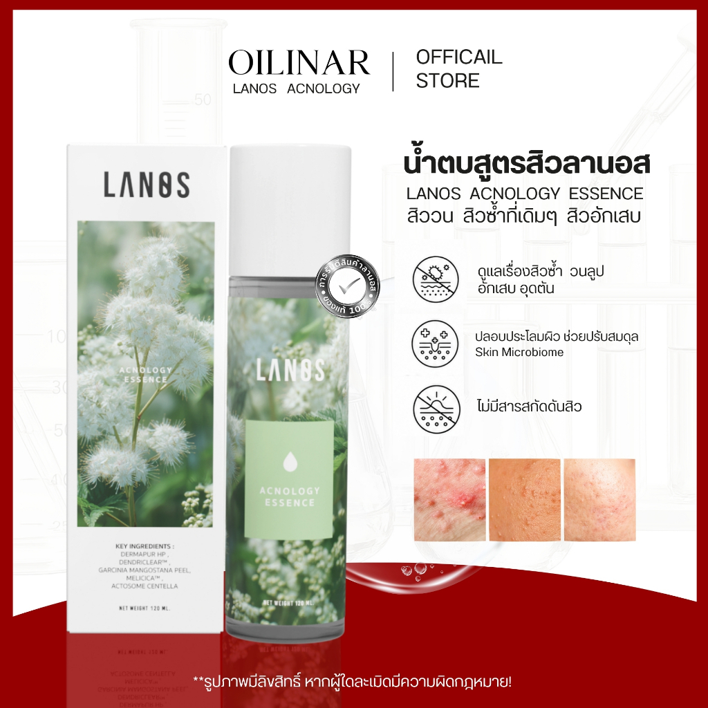 LANOS  น้ำตบลานอสสูตรสิว   น้ำตบสูตรสิว  น้ำตบลานอส  120 ml. (Acnology Essence)  ของเเท้จากบริษัท