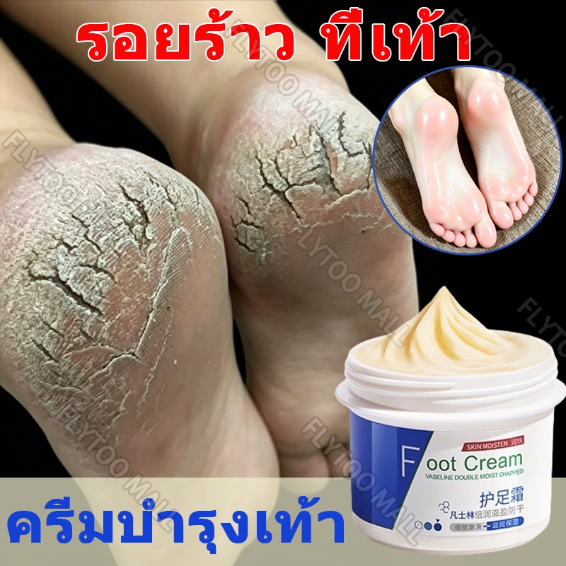 ครีมทาส้นเท้าแตก ครีมทาเท้า ครีมเท้าแตก ครีมบำรุงเท้า ครีมทาเท้าขาว บำรุง ผิวแห้ง และ หยาบกร้าน