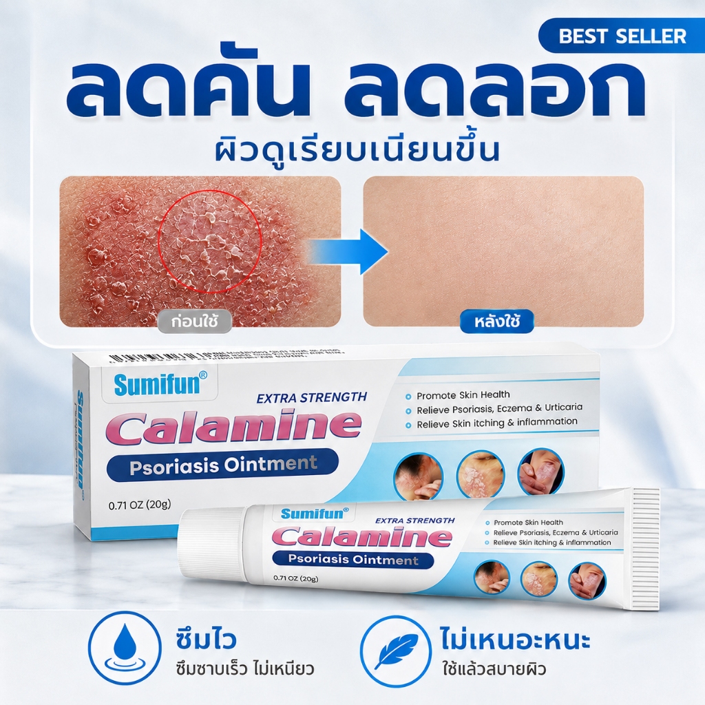 ✨[ต้านเชื้อรา]✨ครีมแก้ผื่นคัน บรรเทาอาการคัน รอยแดง และผิวลอก สูตรอ่อนโยน ซึมง่าย ใช้ได้กับหลายบริเวณ เช่น แขน ขา และเท้