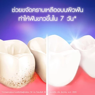 Oral-B ออรัลบี ยาสีฟัน ทรีดีไวท์ ลุกซ์ ลมหายใจหอมสดชื่น 160 กรัมx2 3D White Luxe Fresh BreathToothpaste 160 gx2