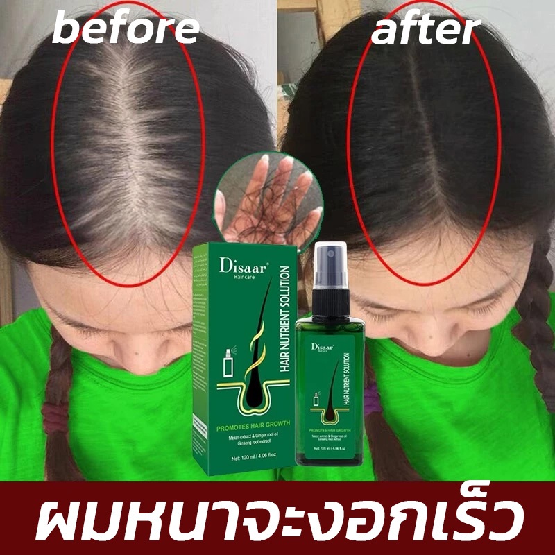 รับประกันของแท้ Disaar นีโอแฮร์ของแท้ 120ML สเปรย์ปลูกผม ผมบาง สเปรย์เซรั่มปิดผมบาง  เก็บเงินปลายทาง น้ำยาปล เซรั่มลดผมร