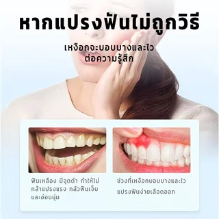 แปรงสีฟัน3D ชุดแปรงสีฟันสามด้าน แปรงสีฟันสามด้าน 360 แปรงสีฟันคุณภาพพรีเมี่ยมขนแปรงนุ่มพิเศษไม่ระคายเหงือก/ฟัน ซอกซอนท