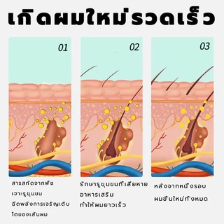 แชมพูขิง ลดผมร่วง บำรุงรากผม เร่งผมยาว ผมแข็งแรง
