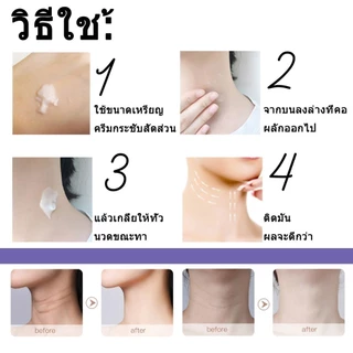 ครีมทาคอ ขาวใส กระชับผิว ลบริ้วรอยบนคอ