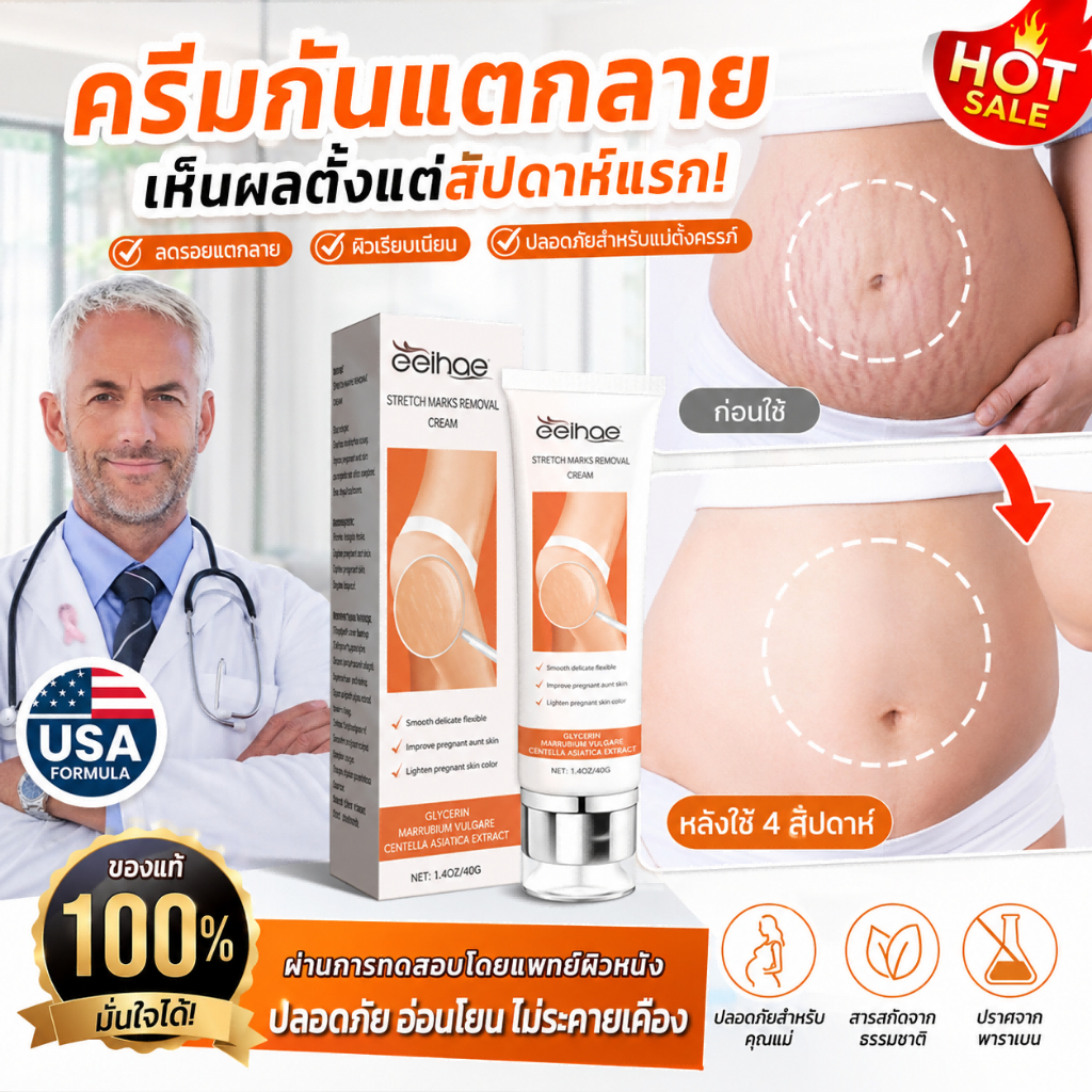 ครีมลดรอยแตกลาย ผิวท้อง ขา สะโพก ทาภายใน 7 วันรอยค่อยๆ หาย ซ่อมแซมผิวลายได้ดี