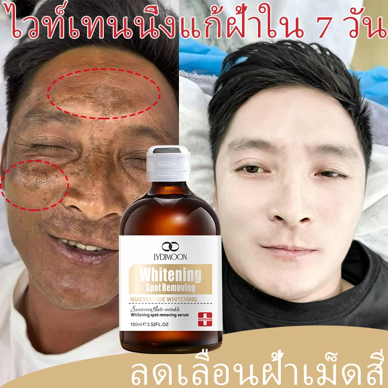 เซรั่มลดฝ้า ครีมลดฝ้า ลดฝ้า กระ จุดด่างดำ ลดความหมองคล้ำ ปรับผิวให้ขาวกระจ่างใส