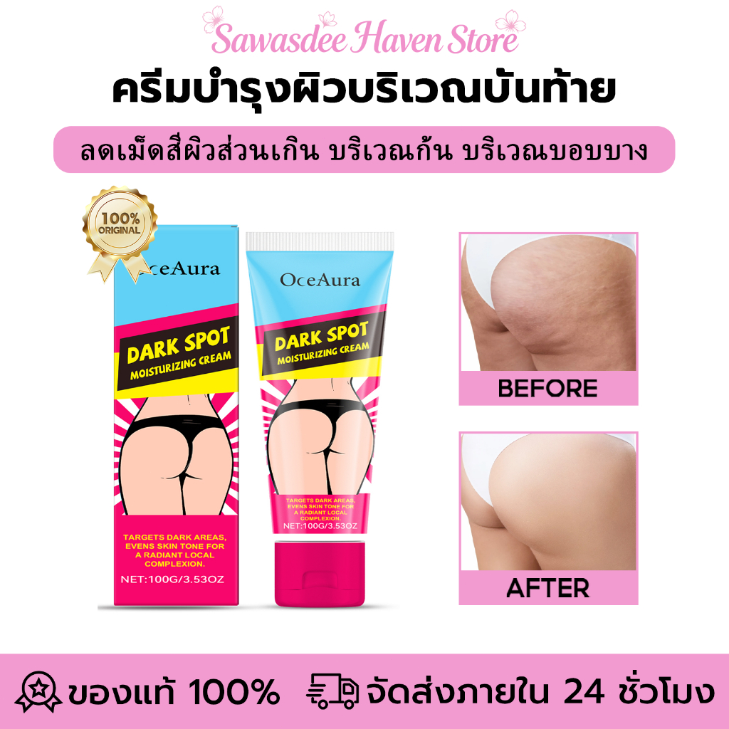OceAura ครีมที่ก้น ครีมทาก้น ครีมบำรุงผิวบริเวณบั้นท้าย ลบเลือนรอยดำ กำจัดเม็ดสีดำบริเวณก้น 100g
