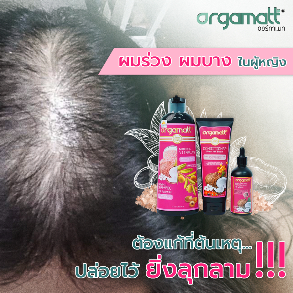 เซตพรีเมียม1 : ชุดเซตแชมพูลดผมร่วงผมบาง พร้อมเซรั่มปลูกผม ออร์แกนิค สำหรับผู้หญิง (แบรนด์ ORGAMATT ออร์กาแมท)
