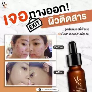 (โปรคู่จิ้น) ครีมวิตซีน้องฉัตร แบบกระปุก + เซรั่มVC น้องฉัตร Vit C Bio Face Serum
