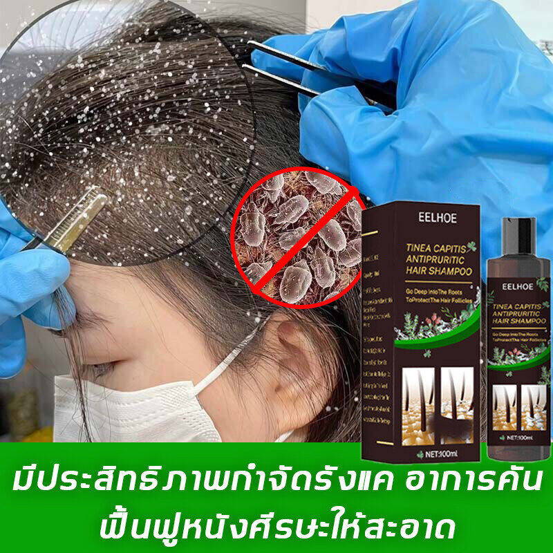 แชมพูแก้คัน ยาสระผม ยาสระผมขจัดรังแค 500ml ยาสระผมผมร่วง แชมพูขจัดรังแค ควบคุมความมัน ขจัดรังแค ลดผมร่วง บํารุงรากผม