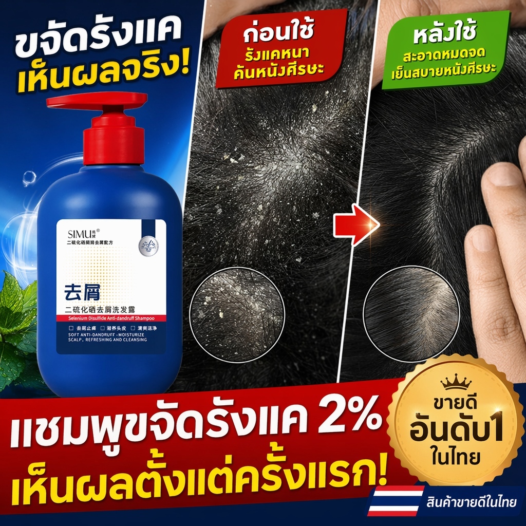 แชมพูทำความสะอาดหนังศีรษะ 300มิล ส่วนผสมซีลีเนียมไดซัลไฟด์ ขจัดรังแคเชื้อราไรฝุ่นควบคุมมัน