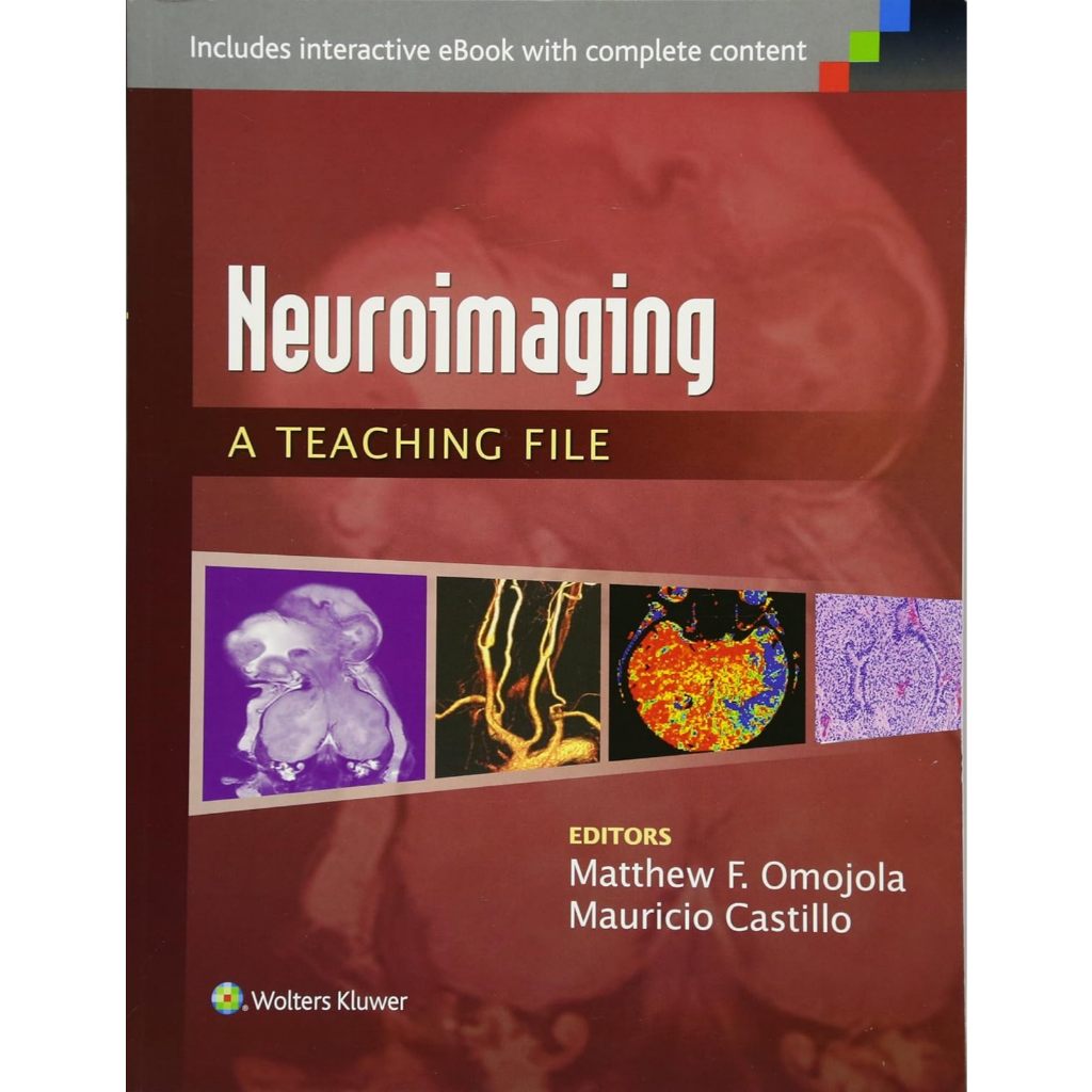หนังสือ Neuroimaging: A Teaching File: A Teaching File (LWW Teaching File Series) ed 1/2015