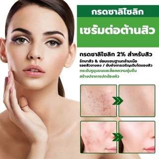 เซรั่มลดสิว 30ml ครีมเจลแต้มรักษาสิว กำจัดสิว ลดรอยสิว ทำรอยสิวจางลง