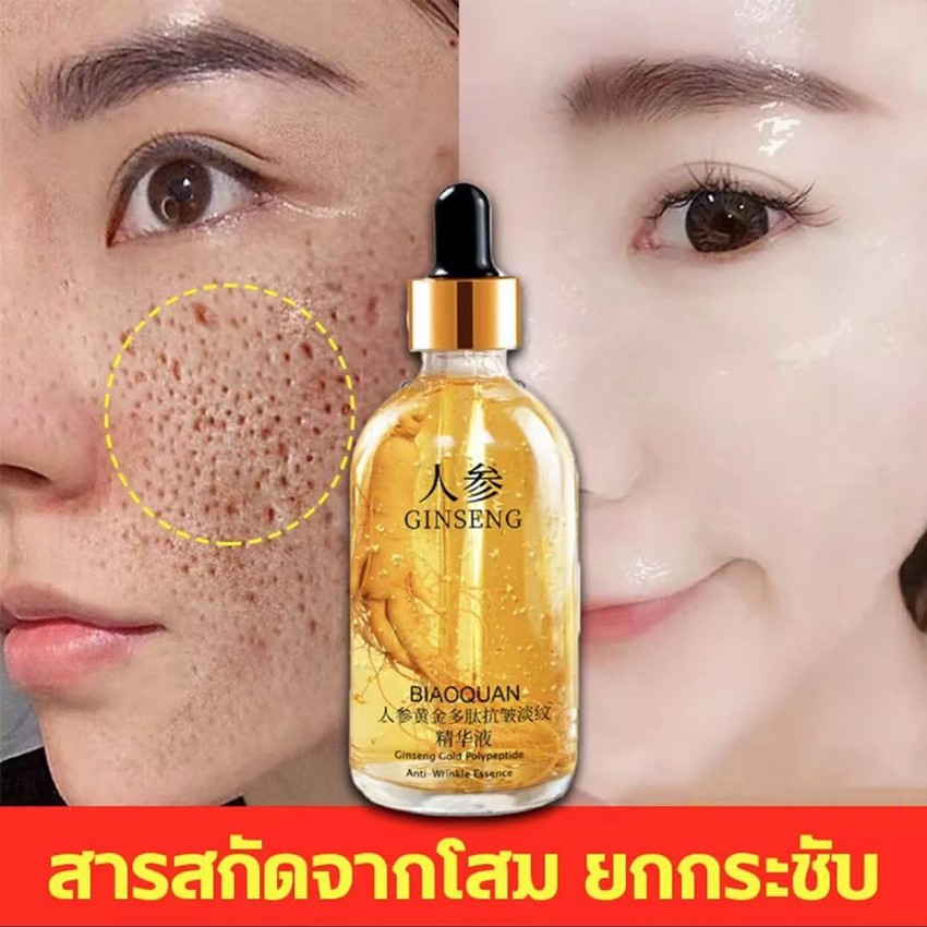 โสมทองเอสเซนส์ ครีมต่อต้านริ้วรอย สารสกัดจากรากโสม เซรั่มหน้าใส เซรั่มบำรุงผิวหน้า อุดมไปด้วยกรดไฮลูโรนิก ไวท์เท