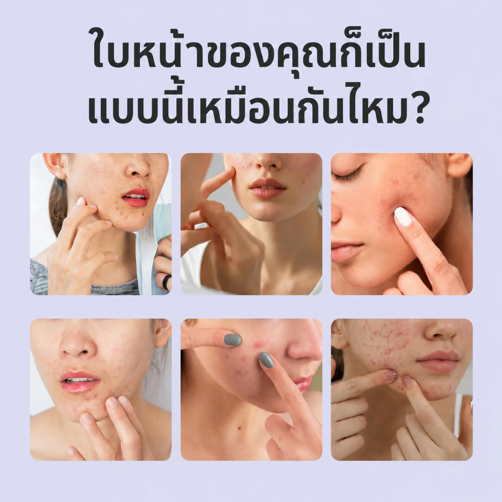 Kreain Nature เจลดูแลผิว Skin Soothing Cream thumbnail 3