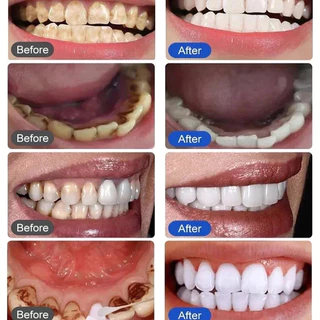 ยาสีฟันฟันขาว ยาสีฟันสมุนไพร ยาสีฟันฟอกฟันขาว 120g ฟอกสีฟัน ลดคราบฟันเหลือง ลดฟันเหลือง ลดหินปูน ฟอกฟัน ลดกลิ่นปาก