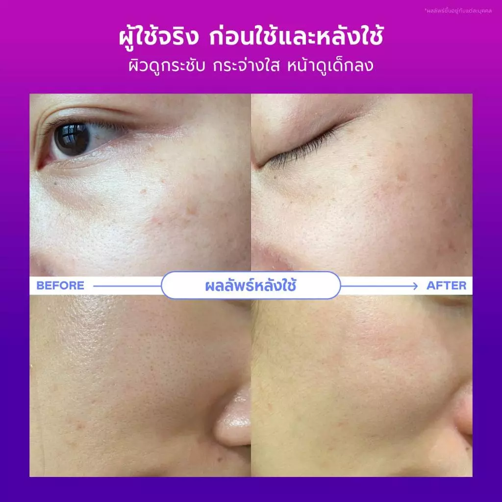 DIVYNE Birthday Multi-Lift Trio | เซตสกินแคร์ โปรโมชั่นวันเกิดครบสูตรลดเลือนริ้วรอย เพื่อผิวอ่อนเยาว์เหนือกาลเวลา thumbnail 8
