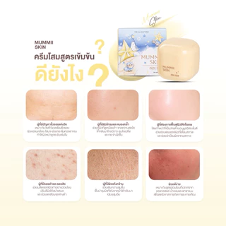 Mummii Skin Cream ครีมโสมมัมมิ๊ - ครีมมี๊หนม 15 ml