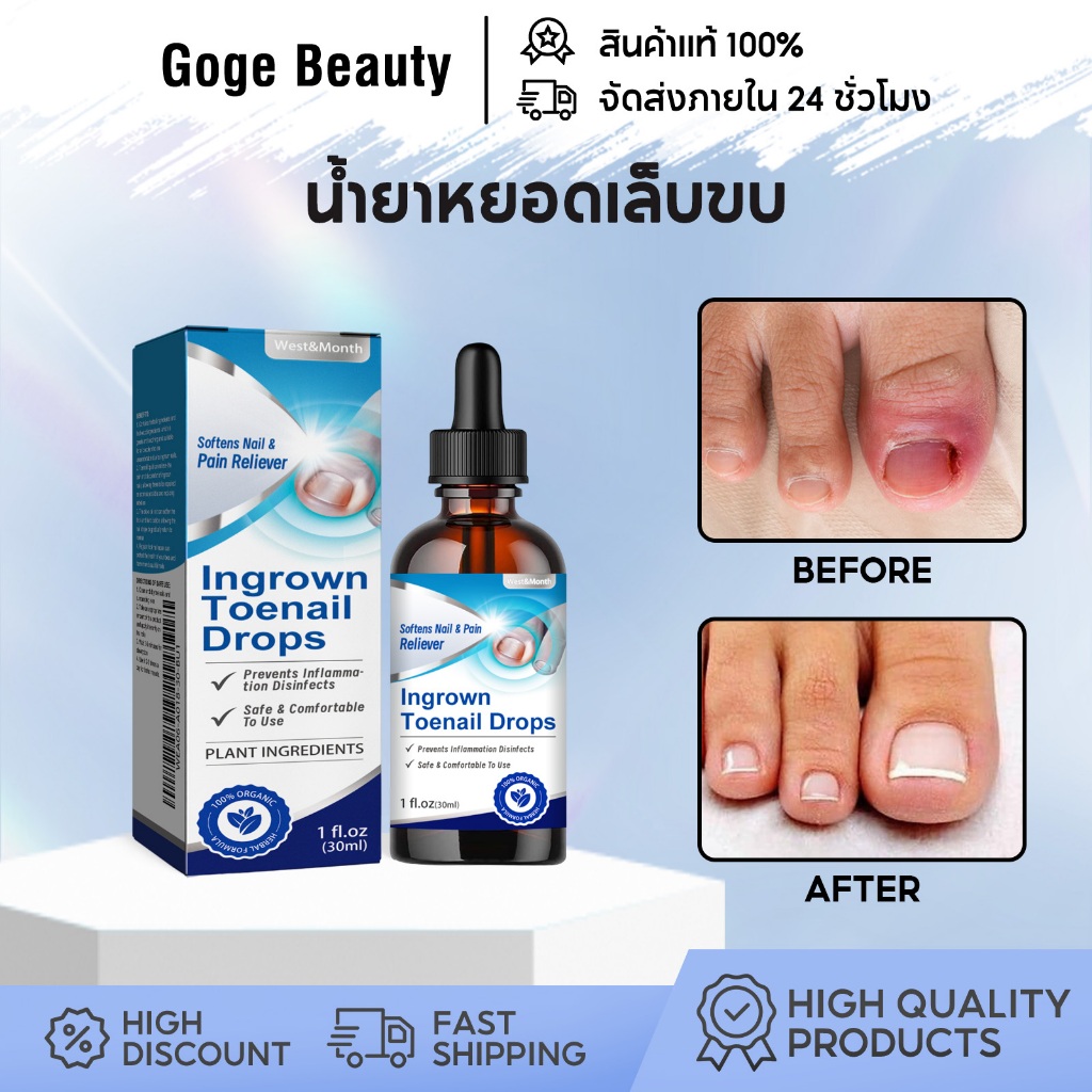 West&Month น้ำยาหยอดเล็บขบ Ingrown Toenail Drops บรรเทาอาการปวด ซ่อมแซมเล็บ รักษาเชื้อรา 30ml