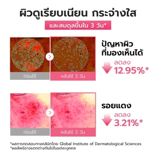 MEDICUBE Ultra Light PDRN Pink Peptide Serum 30ml เมดิคิวบ์ อัลตร้า ไลท์ พีดีอาร์เอ็น พิงค์ เพปไทด์ เซรั่ม