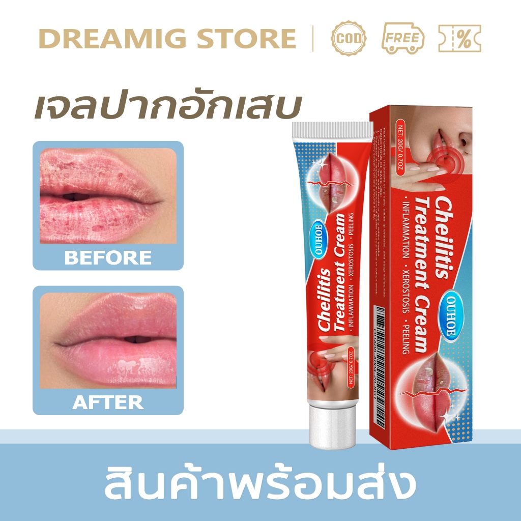 OUHOE ครีมดูแลริมฝีปาก 20g สูตรอ่อนโยนบำรุงเติมน้ำ ให้ริมฝีปากอวบอิ่มชุ่มน้ำ นุ่มลื่นสวยงาม ทาแล้วไม่เหนียวเหนอะหนะ ดูแล
