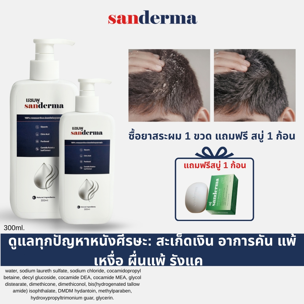 แชมพู Sanderma ลดอาการคันและเชื้อราบนหนังศีรษะ ช่วยปลอบประโลมหนังศีรษะ