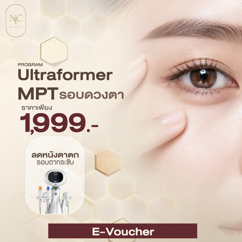 Ultraformer MPT HIFU ยกกระชับใต้ตา ลดริ้วรอย Eye Lift 100 Shot | NTC Clinic