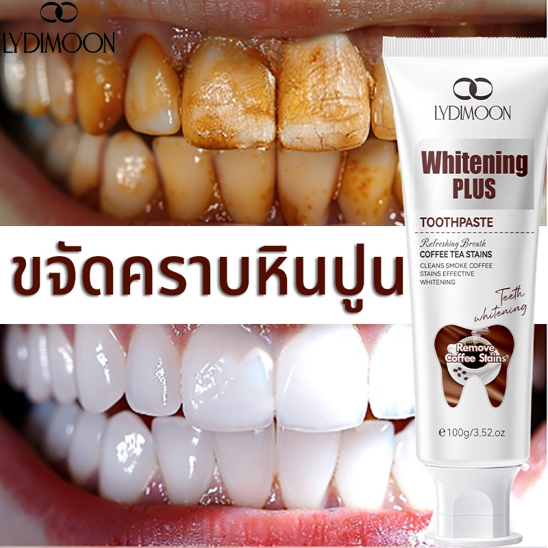 [COD]ยาสีฟันไวท์เทนนิ่ง 100g ยาสีฟันขาว ขจัดคราบกาแฟคราบชา ลดคราบหินปูน ฟันเหลือง ลดกลิ่นปาก ปกป้องเหงือก ยาสีฟันสมุนไพร