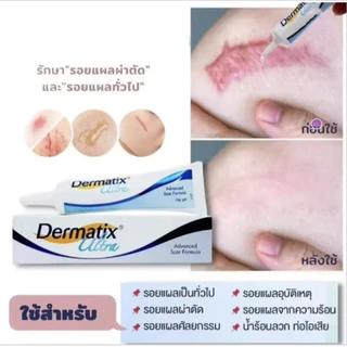 ซื้อ 2 แถม 1 ยาทาแผลเป็น เจลกู้ผิว ทาแผลเป็น ลดรอยแผลเป็น ยาลดรอยแผลเป็น ลบรอยแผลเป็น ครีมแผลเป็น น้ำร้อนลวก รอยสิว 15g