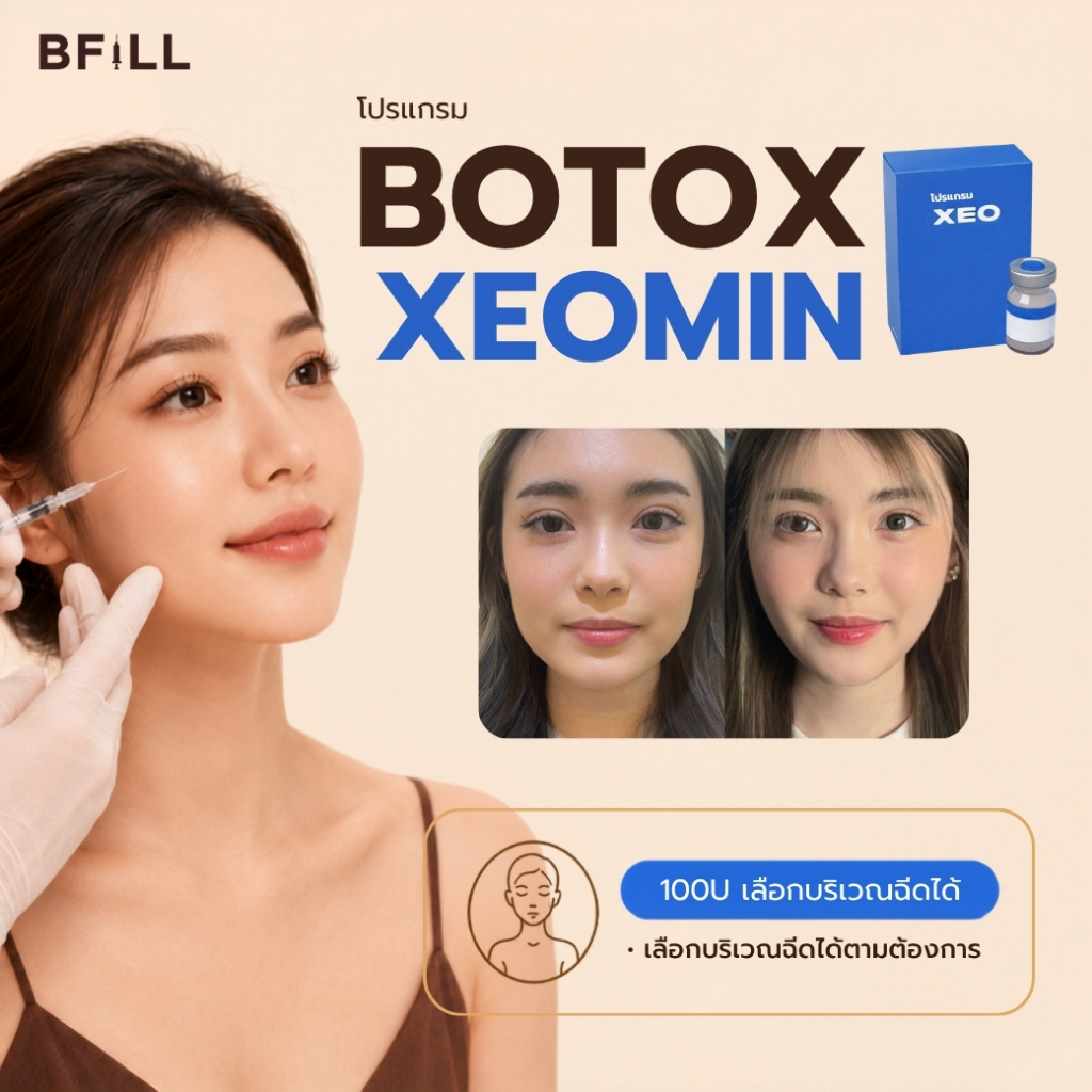 BFiLL โปรแกรม Botox Xeomin โบท็อกซ์ริ้วรอย โบท็อกซ์หน้าผาก โบท็อกซ์หว่างคิ้ว โบท็อกซ์ตีนกา โบท็อกซ์ห
