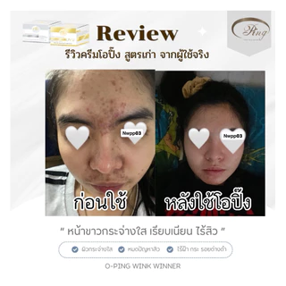 ครีมลดสิว หน้าใส โอปิ๊ง สูตรเก่าดั้งเดิม - OPING WINK WINNER CREAM