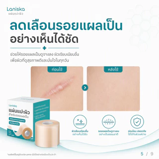 Laniska แผ่นแปะ ซิลิโคน ลดรอยแผลเป็น 4cm*150cm ซิลิโคนแปะแผลเป็น แปะแผลเป็น ลดรอยสิว แผลเป็นหลุม ไหมเย็บแผล แผลผ่าตัด
