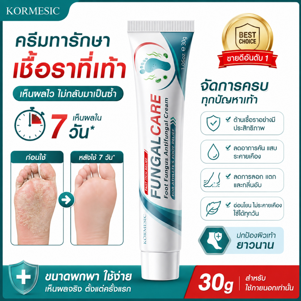 โปรพิเศษ KORMESIC ครีมเชื้อราที่เท้า ครีมดูแลเท้า 30g ลดอาการคันและระคายเคือง ใช้ทาภายนอก