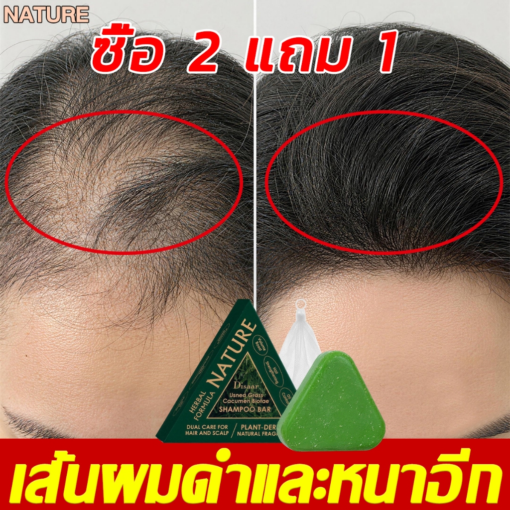 【ซื้อ 2 แถม 1】แชมพูสมุนไพร 360g ลดผมร่วง บำรุงรากผม ผมหนาดกดำ สูตรอ่อนโยน จากส่วนผสมธรรมชาติ แชมพูจากพืชบาร์ สบู่สมุนไพร