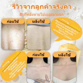 เจลอาบน้ำกำมะถัน ช่วยกำจัดไรขนาดเล็ก ลดสิวหลัง แผลอักเสบรูขุมขน ทำความสะอาดล้ำลึก เหมาะสำหรับผิวแพ้ง่าย ขนาด 500 มล