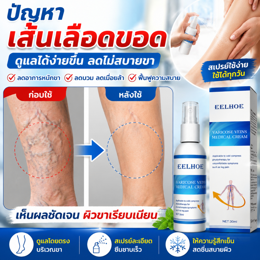 บรรเทาอย่างรวดเร็ว สเปรย์เส้นเลือดขอด ช่วยให้เส้นเลือดโป่งพองและเรียบเนียน ลดอาการล้าขา ดูแลผิวขาให้สบายขึ้น พกพาง่าย